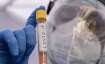 India, COVID-19 tests, ICMR, coronavirus pandemic, covid second wave, corona news, testing, active c